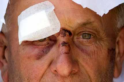 σεισμόπληκτος από το χωριό Onna(REUTERS/Chris Helgren) 